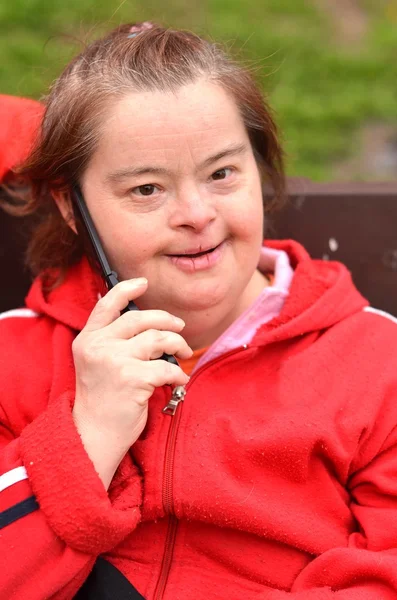 Синдром Дауна женщина с мобильным телефоном — стоковое фото