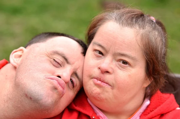 Casal com Síndrome de Down — Fotografia de Stock