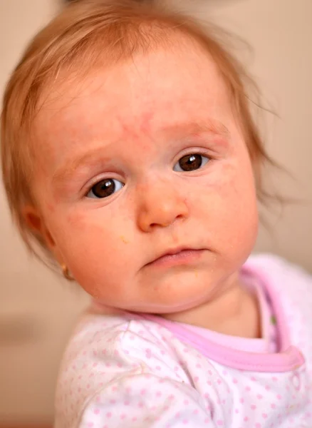 Bebek hasta — Stok fotoğraf
