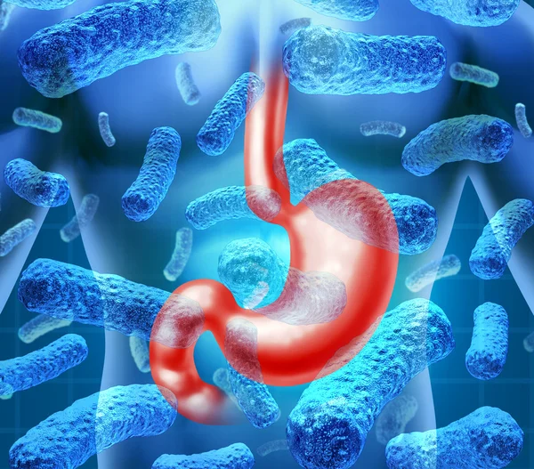 Stomach Infection — Stock Photo, Image