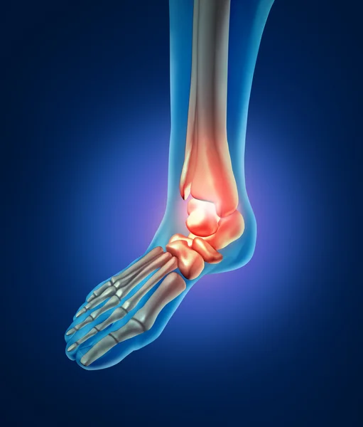 Menselijke voet pijn — Stockfoto