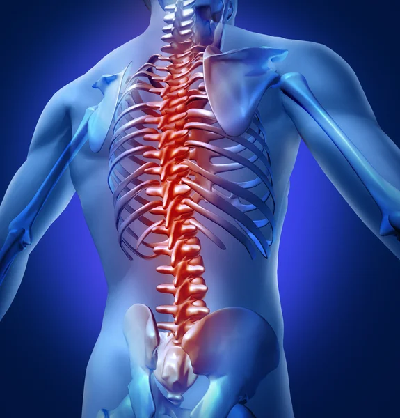 Mensch-Rücken-Schmerzen — Stockfoto
