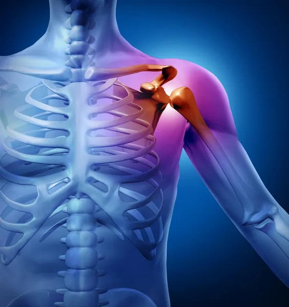 Insan omuz ağrısı — Stok fotoğraf