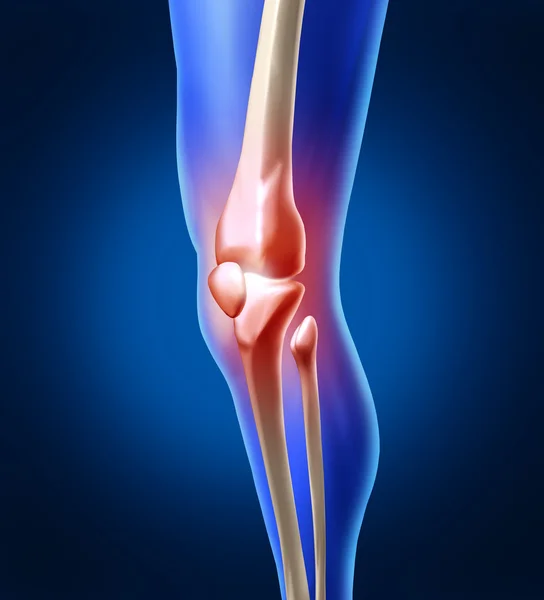 Dolore al ginocchio umano — Foto Stock