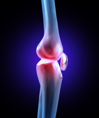 Knee Joint Pain clipart