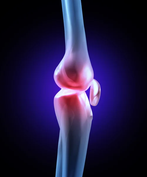 Douleur articulaire du genou — Photo