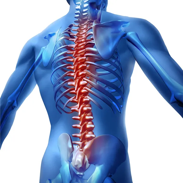 Rückenschmerzen im menschlichen Körper — Stockfoto
