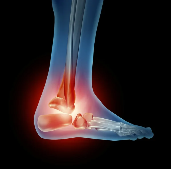 Πόδι πόνο στον αστράγαλο — Φωτογραφία Αρχείου