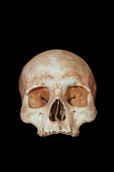 A human skull on a black background.