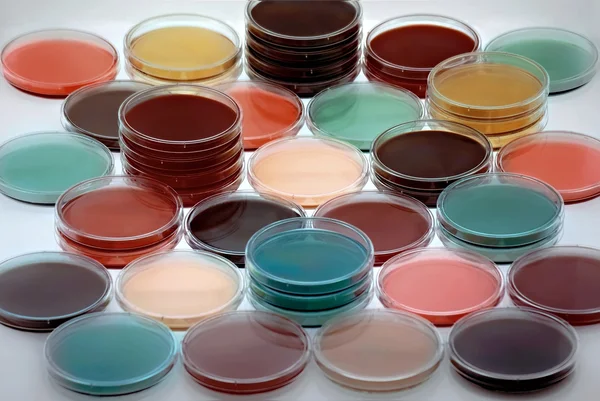 Petri dishes with culture medium — Stock Photo, Image