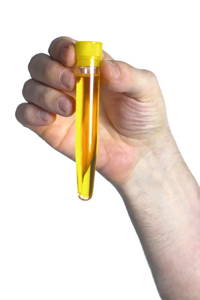 Hand of a patient with a container of urine for a test — Stock Photo, Image