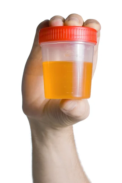 Recipiente de urina — Fotografia de Stock