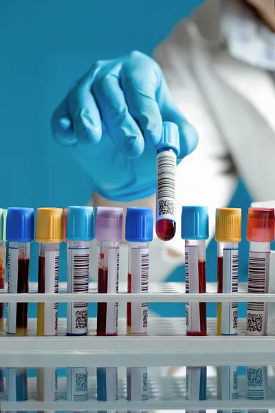 Una mano che disegna un tubo campione di sangue — Foto Stock