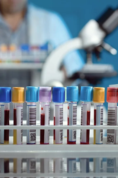 Bandeja com tubos com amostras de sangue — Fotografia de Stock