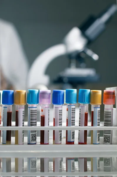 Rack with blood samples — Zdjęcie stockowe