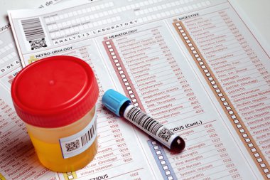 Medical report and test containers to an analytical study clipart