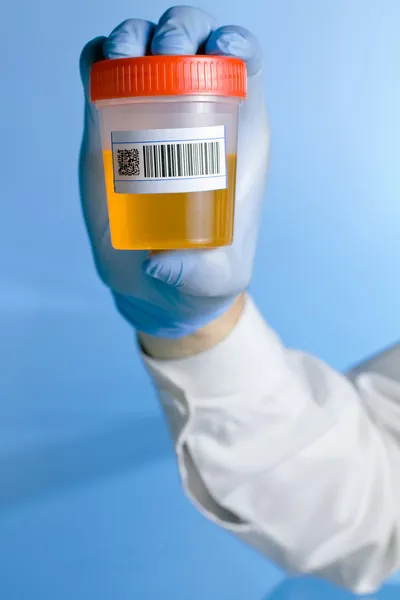 Conteneur d'urine avec barre de code en fond bleu — Photo