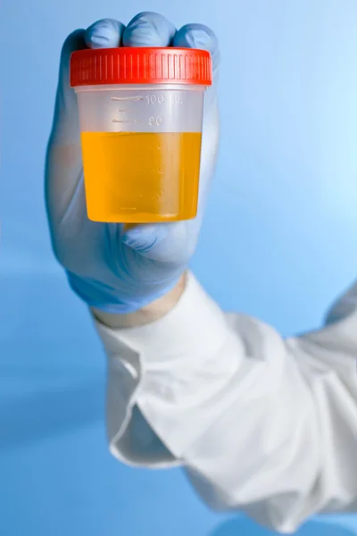 Conteneur d'urine en fond bleu — Photo