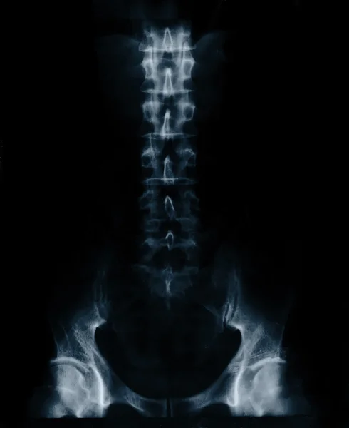 X-RAY film of male lower thorax and pelvis — Stock Photo, Image
