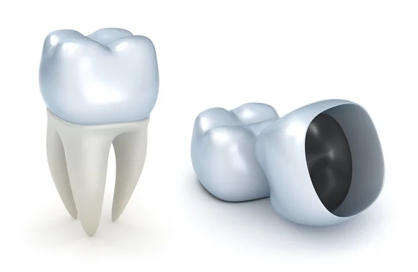 Стоматологические коронки и зуб, изолированные на белом — стоковое фото