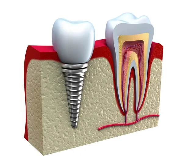 Anatomi av friska tänder i Detaljer — Stockfoto