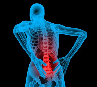 Painful joints x-ray body clipart