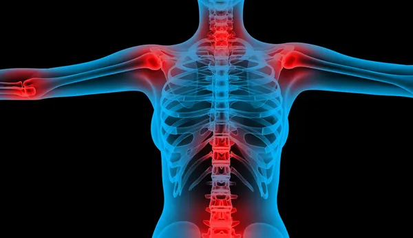 Bóle stawów x-ray niski ciało — Zdjęcie stockowe