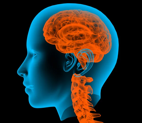 Röntgenbild eines männlichen Skeletts mit Gehirn, isoliert auf schwarzem Hintergrund — Stockfoto