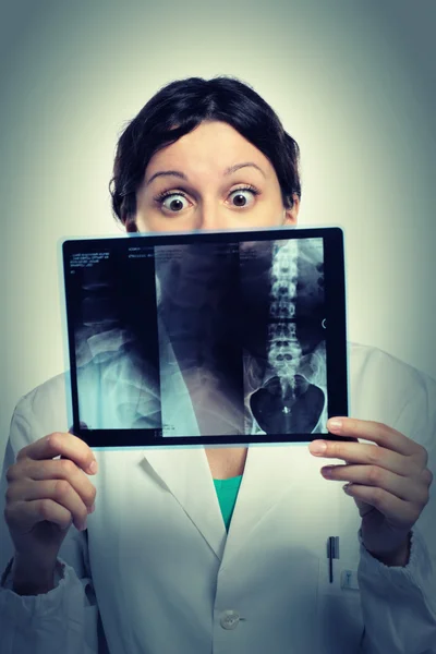 Ung kvinnlig läkare tittar förvånad på en röntgenbild — Stockfoto