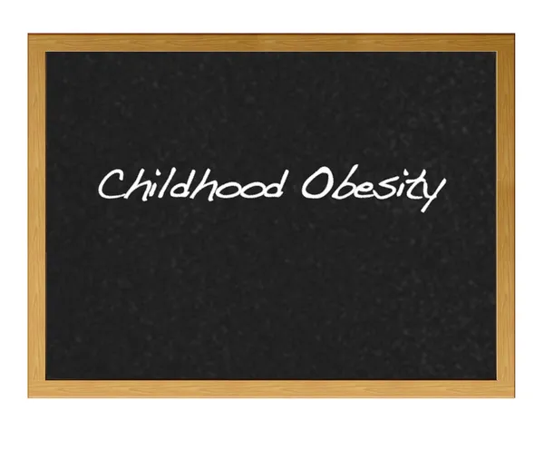Obesitas bij kinderen. — Stockfoto
