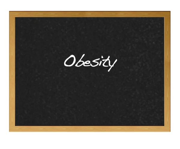 Obesitas. — Stockfoto