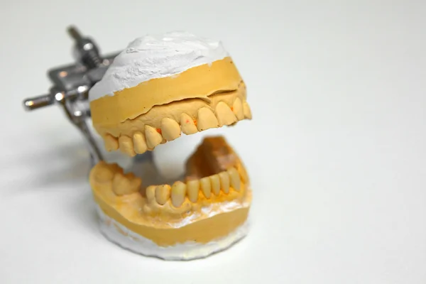 Molde dental — Foto de Stock
