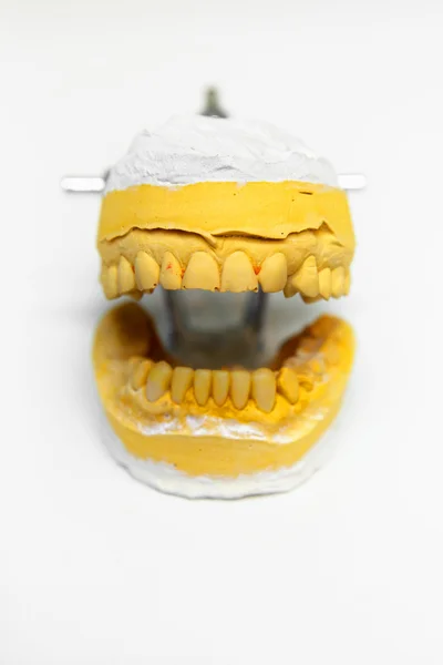Зубная плесень — стоковое фото