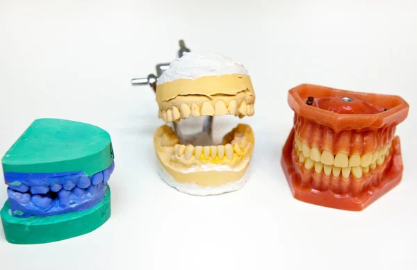 Formy zęba — Zdjęcie stockowe