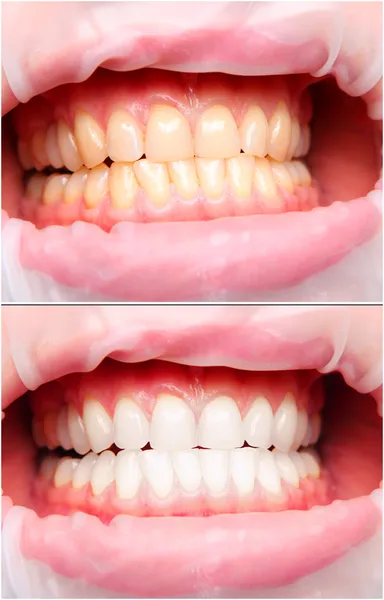 여성의 치아 스톡 사진
