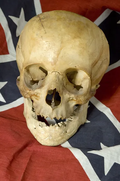 Cráneo confederado — Foto de Stock