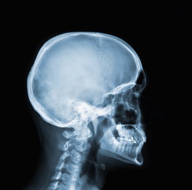 X-ray of head clipart