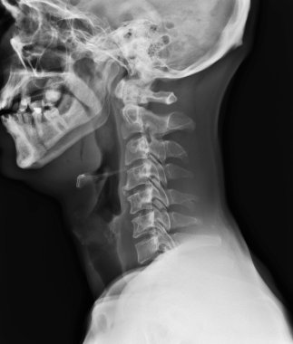 X-ray of neck clipart