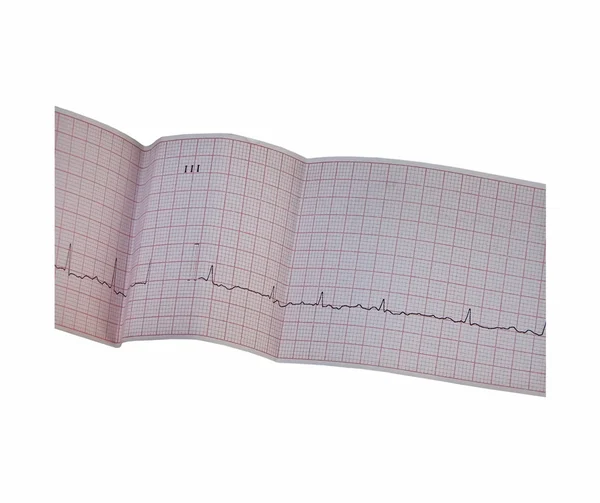 stock image Electrocardiogram