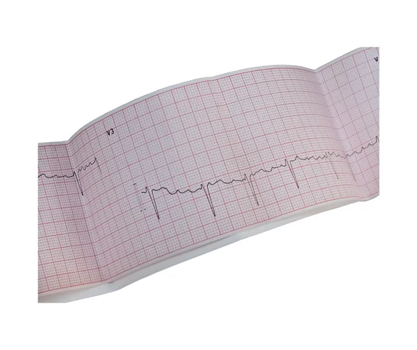 stock image Electrocardiogram