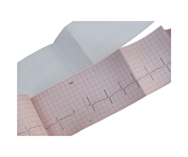 stock image Electrocardiogram