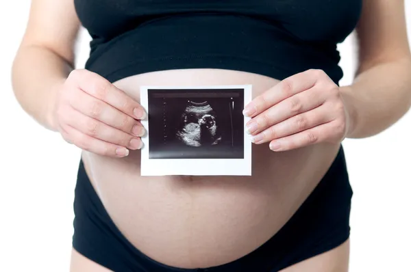 Ultrasound picture — Stock Photo, Image