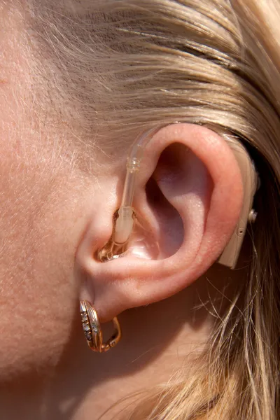 stock image Digital hearing aids