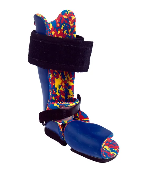 子供の clubfoot の補正のための整形外科装置. — ストック写真