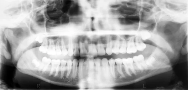 Radiografía de la cavidad oral . — Foto de Stock