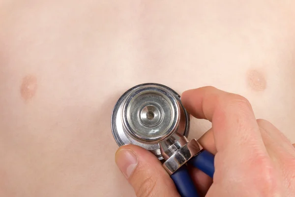 Stetoskop w klatce piersiowej — Zdjęcie stockowe