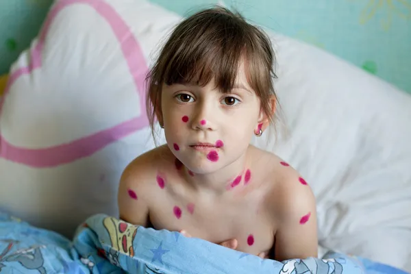 Άρρωστο κορίτσι στο κρεβάτι — Φωτογραφία Αρχείου
