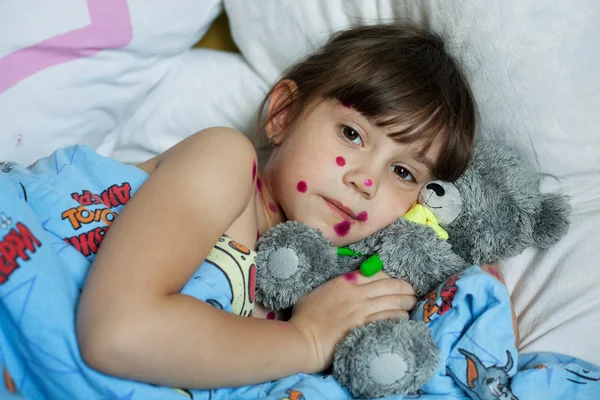 Stock image The little girl suffering from chicken pox