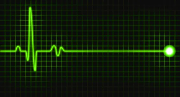 Gráfico de pulso verde en pantalla negra — Foto de Stock