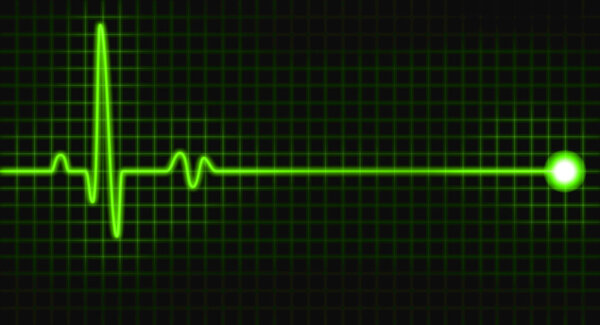 Граф зелёных импульсов на чёрном экране
